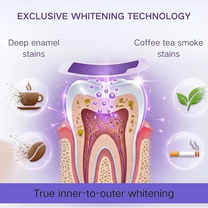 BrightAura™ Purple Teeth Whitening Strips (Pack of 7)